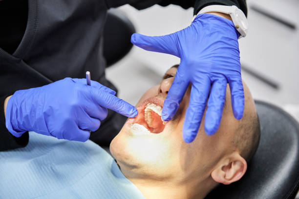 Best Chipped Tooth Repair Near Me  in USA